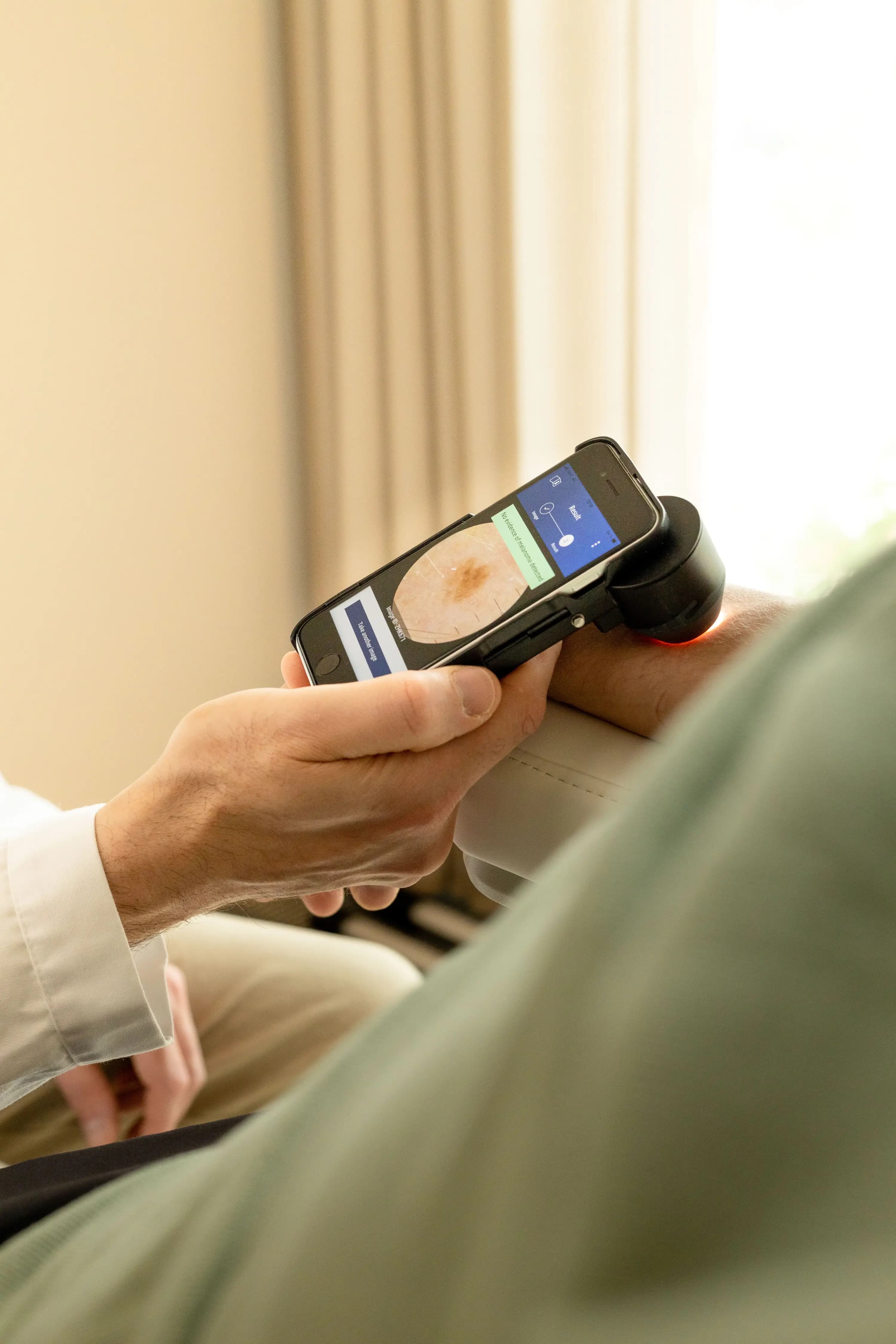 Placeholder image of Dermalyser in use.