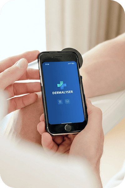 Dermalyser on a mobile device